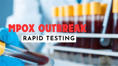 brunei 4d result|WHO urges rapid access to mpox diagnostic tests, .